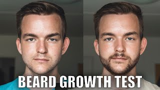 CPH Grooming vs Minoxidil  I tried both Beard Growth [upl. by Airdni]