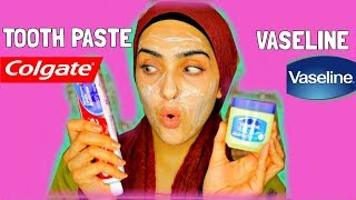 I APPLIED TOOTHPASTE AND VASELINE ON MY FACE  Look What Happened   Immy [upl. by Olraced789]