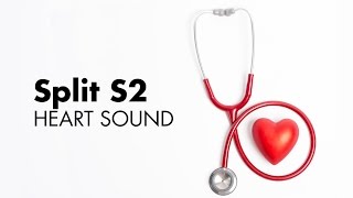 Fixed Split S2  Heart Sounds  MEDZCOOL [upl. by Anitsirhk646]