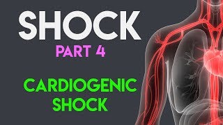 Cardiogenic Shock  Shock Part 4 [upl. by Corette]