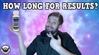 quotHow Long Before I See Resultsquot  Minoxidil Beards  BeardTalk  Ep 4 [upl. by Boyt]