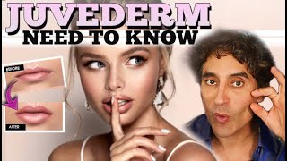 JUVEDERM  Juvederm Before and After [upl. by Geraint220]