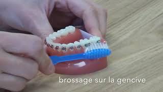 Comment brosser ses dents avec un appareil [upl. by Blanche]