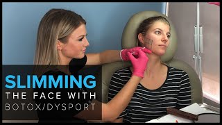 Slimming the Face with BOTOX and Dysport in San Francisco [upl. by Clymer]