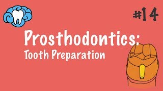 Prosthodontics  Tooth Preparation  INBDE ADAT [upl. by Uwton]