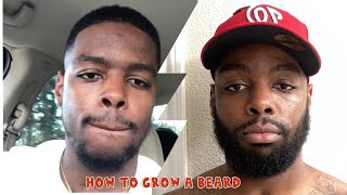 How to Grow a Beard  UPDATE Minoxidil [upl. by Htinek947]