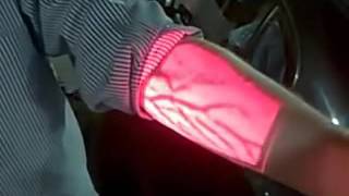 Vein Finder Demonstration [upl. by Laith866]