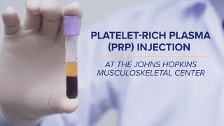 PlateletRich Plasma PRP Injections  QampA [upl. by Introc]