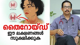 തൈറോയ്ഡ് ഈ രോഗ ലക്ഷണങ്ങൾ സൂക്ഷിക്കുക  Thyroid Malayalam Health Tips [upl. by Star]