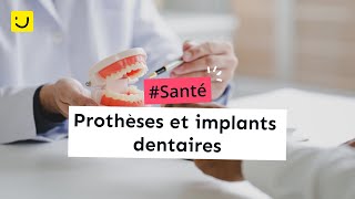 Prothèses et implants dentaires [upl. by Darice820]