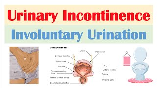 Urinary Incontinence Stress Urge Overflow amp Functional  Causes Symptoms Diagnosis Treatment [upl. by Ellivro]