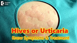 10 tips to HEAL YOUR ECZEMA Dr Dray [upl. by Gilroy]