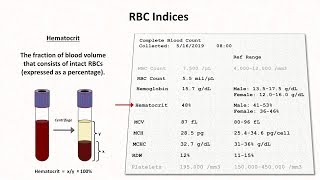 How to Interpret RBC Indices eg hemoglobin vs hematocrit MCV RDW [upl. by Ylliw]