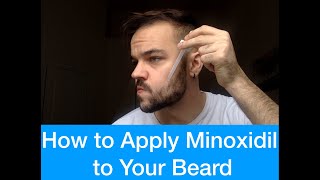 How to Apply Minoxidil to Your Beard For Beginners [upl. by Felic]