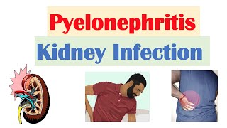 Pyelonephritis Kidney Infection  Causes Pathophysiology Signs amp Symptoms Diagnosis Treatment [upl. by Berglund]