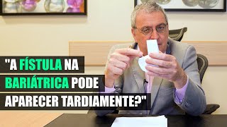 A fístula na bariátrica pode aparecer tardiamente [upl. by Raul482]