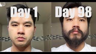 I Grew Out My Beard For 3 Months Using Minoxidil Rogaine [upl. by Ingeborg]