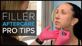 How To Fill The Cheeks With A Dermal Filler Using A Fanning Technique [upl. by Rodablas]