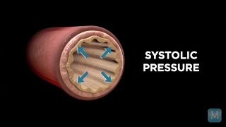 Low Diastolic Blood Pressure Symptoms [upl. by Ardussi]