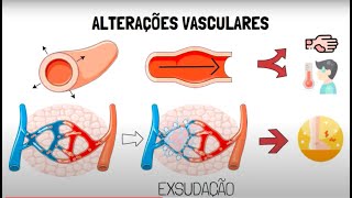 Inflamação Aguda [upl. by Avihs223]