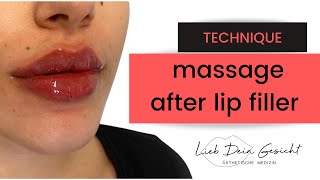 Lip Filler Massage and how to fix Bumps [upl. by Ymassej101]