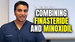 Combining Finasteride and Minoxidil Therapies [upl. by Auhsej249]