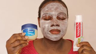 I APPLIED COLGATE TOOTHPASTE AND VASELINE ON MY FACE TO SEE WHAT HAPPENED [upl. by Enaile]