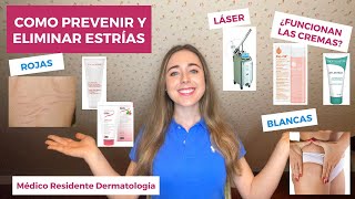 CÓMO PREVENIR Y ELIMINAR LAS ESTRÍAS BLANCAS Y ROJAS  BIOOIL ACEITE LÁSER  ¿FUNCIONAN EMBARAZO [upl. by Onitsuj]