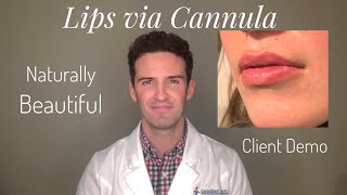 Lips DemoTutorial Cannula amp BD syringe [upl. by Yerfej]